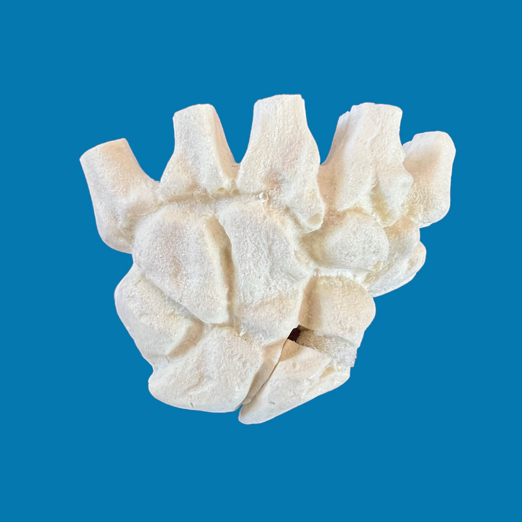 Mano con fractura escafoide, izquierda.