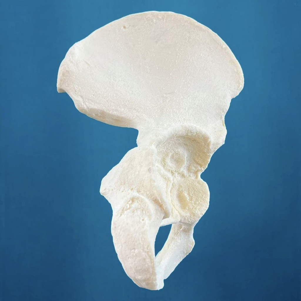 Hemipelvis pediátrica con acetábulo de 38 mm, derecha