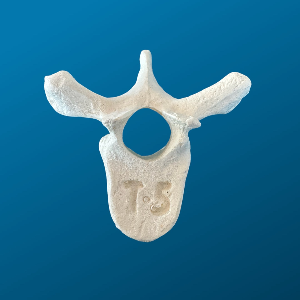 T5