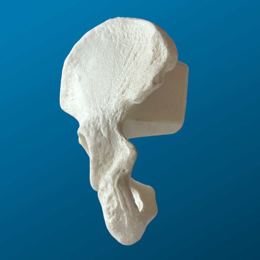 Hemipelvis con acetábulo de 54 mm, izquierda, con accesorio de tornillo de banco.