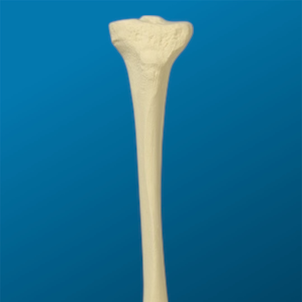 Tibia con una longitud total de 30 cm, con canal y esponjoso, izquierda