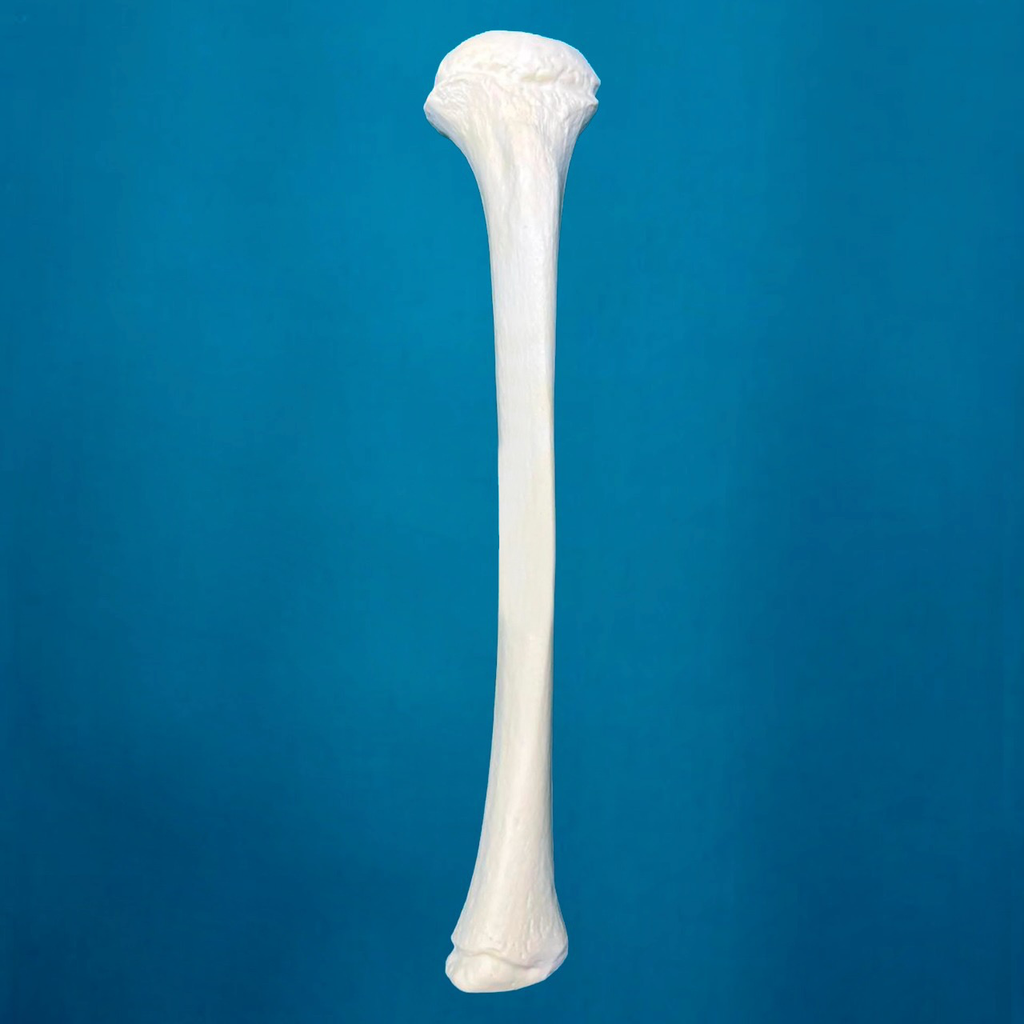 Tibia pediátrica, izquierda