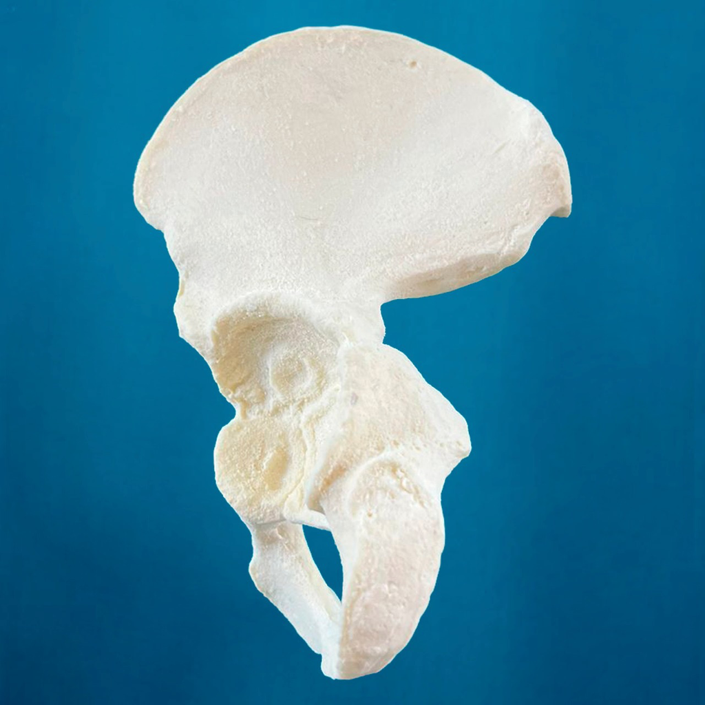 Hemipelvis pediátrica con acetábulo de 38 mm, izquierda