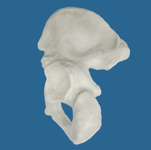 [1110-10] Hemipelvis con acetábulo de 57 mm, derecho