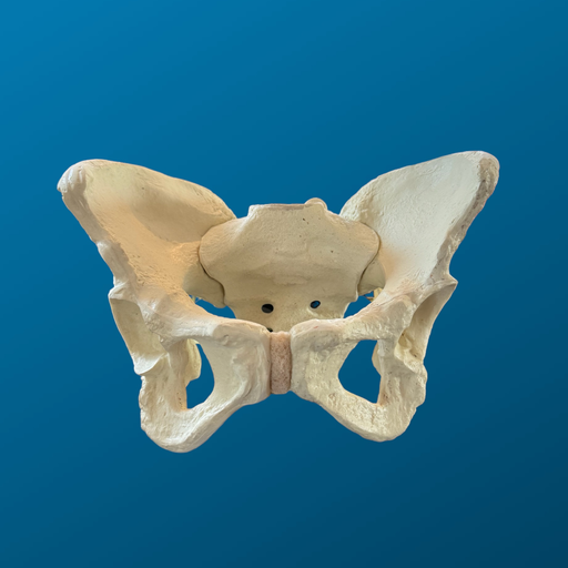 [1122] Pelvis Displasica