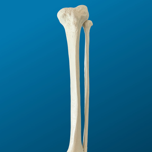[1128] Tibia con peroné, con esponjoso, espuma solida, izquierda