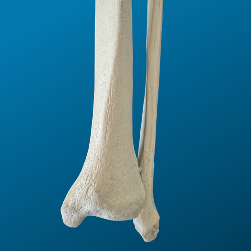 [1158] Tibia y peroné, distal, espuma solida, izquierdo