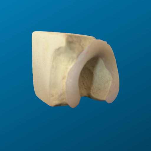 [1130] Acetabulo en bloque con labrum