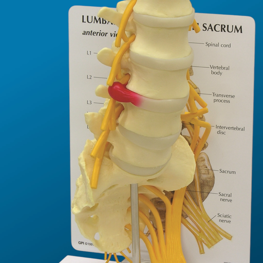 [1606] L1-L5 con sacro y disco herniado.