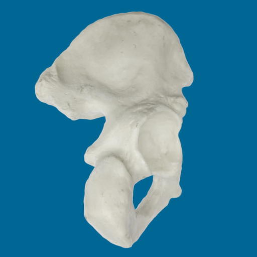 [1110] Hemipelvis con acetábulo de 57 mm, izquierdo