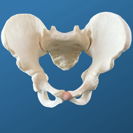 [1113] Pelvis completa pediátrica con isquion y pubis definidos. Acetábulo de 38 mm